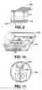Fig. 10 - Arteriovenous access valve system and process