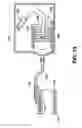 Fig. 12 - Arteriovenous access valve system and process