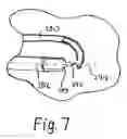 Fig. 08 - Liquid jet surgical instrument