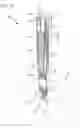 Fig. 12 - Injector device with force lock-out and injection rate limiting mechanisms