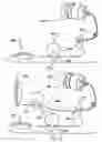 Fig. 02 - Adjustable infusion catheter