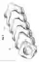 Fig. 05 - Catheter shaft with undulating surface for reduced friction