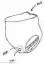 Fig. 01 - Absorbent article having a wetness event counter