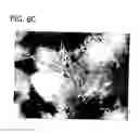 Fig. 11 - ABSORBENT ARTICLES