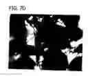 Fig. 16 - ABSORBENT ARTICLES