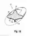 Fig. 23 - ABSORBENT ARTICLES
