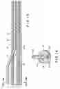 Fig. 08 - Intravascular catheter