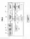 Fig. 03 - Encapsulated medical device and method of examining, curing, and treating internal region of body cavity using encapsulated medical device