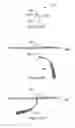 Fig. 30 - Systems, devices, and methods for treating pelvic floor disorders