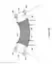Fig. 35 - Systems, devices, and methods for treating pelvic floor disorders