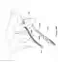 Fig. 50 - Systems, devices, and methods for treating pelvic floor disorders