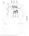 Fig. 52 - Systems, devices, and methods for treating pelvic floor disorders