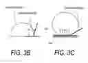 Fig. 08 - Supercavitating medical probe and method of use