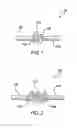 Fig. 02 - Apparatus and methods for spinal implant with dynamic stabilization system