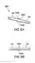 Fig. 09 - Apparatus and methods for spinal implant with dynamic stabilization system