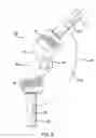 Fig. 09 - Spinal rod connector