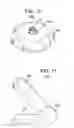 Fig. 09 - Methods and apparatus for vertebral stabilization using sleeved springs