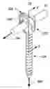 Fig. 01 - Spinal stabilization using bone anchor seat and cross coupling with improved locking feature