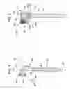 Fig. 02 - Spinal stabilization using bone anchor seat and cross coupling with improved locking feature