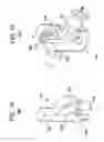 Fig. 09 - Spinal stabilization using bone anchor seat and cross coupling with improved locking feature