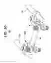Fig. 12 - Spinal stabilization using bone anchor seat and cross coupling with improved locking feature