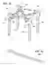 Fig. 19 - Spinal stabilization using bone anchor seat and cross coupling with improved locking feature
