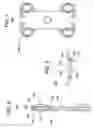 Fig. 04 - Method and apparatus for providing a retainer for a bone stabilization device