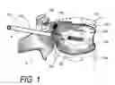 Fig. 02 - Biomedical treatment systems and methods