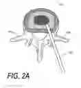 Fig. 03 - Biomedical treatment systems and methods