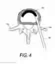 Fig. 06 - Biomedical treatment systems and methods
