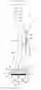 Fig. 01 - Surgical introducer