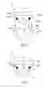 Fig. 08 - Surgical introducer
