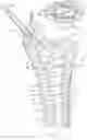 Fig. 08 - Vertebral body having an altered native cancellous bone volume and related treatment methods