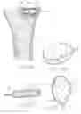 Fig. 10 - Vertebral body having an altered native cancellous bone volume and related treatment methods
