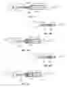 Fig. 04 - Methods and apparatus for inserting an intraocular lens into an eye