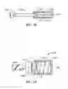 Fig. 11 - Methods and apparatus for inserting an intraocular lens into an eye