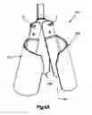 Fig. 09 - Expandable access device with mobility member