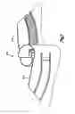 Fig. 14 - Expandable access device with mobility member