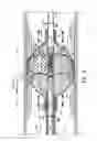 Fig. 09 - Cross stream thrombectomy catheter with flexible and expandable cage