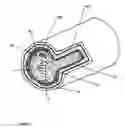 Fig. 03 - Forward-directed atherectomy catheter