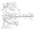 Fig. 01 - Methods and apparatus for removing veins