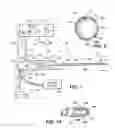 Fig. 02 - Methods and apparatus for removing veins