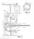 Fig. 05 - Methods and apparatus for removing veins