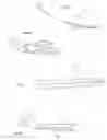 Fig. 05 - Surgical tool and method for extracting tissue from wall of an organ