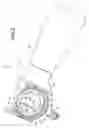 Fig. 03 - Keratome with suspended stabilized blade, applanator and guided engagement with keratome cutter head