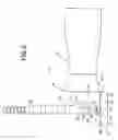 Fig. 04 - Keratome with suspended stabilized blade, applanator and guided engagement with keratome cutter head