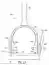 Fig. 16 - Keratome with suspended stabilized blade, applanator and guided engagement with keratome cutter head