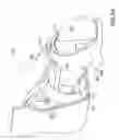 Fig. 28 - Keratome with suspended stabilized blade, applanator and guided engagement with keratome cutter head