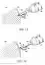 Fig. 12 - Methods and devices for cutting and collecting soft tissue