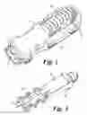 Fig. 02 - Lancets